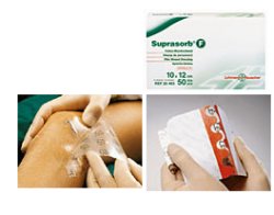 MEDICAZIONE STERILE IN FILM IN POLIURETANO TRASP. SUPRASORB F 10X12CM 10 PEZZI - farmascienza.it