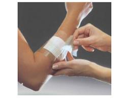 FILM ADESIVO IN POLIURETANO OPSITE FLEXIFIX IN ROTOLO TRASPARENTE IMPERMEABILE PER FISSAGGIO DI MEDICAZIONI E CATETERI LARGHEZZA 15 CM LUNGHEZZA 10 M 1 PEZZO - farmascienza.it